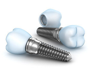 dental implants wayne nj